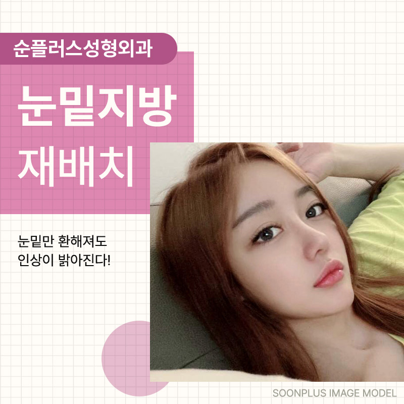 눈밑지방수술 꺼짐과 돌출이 동반되었을때 관련 이미지 1