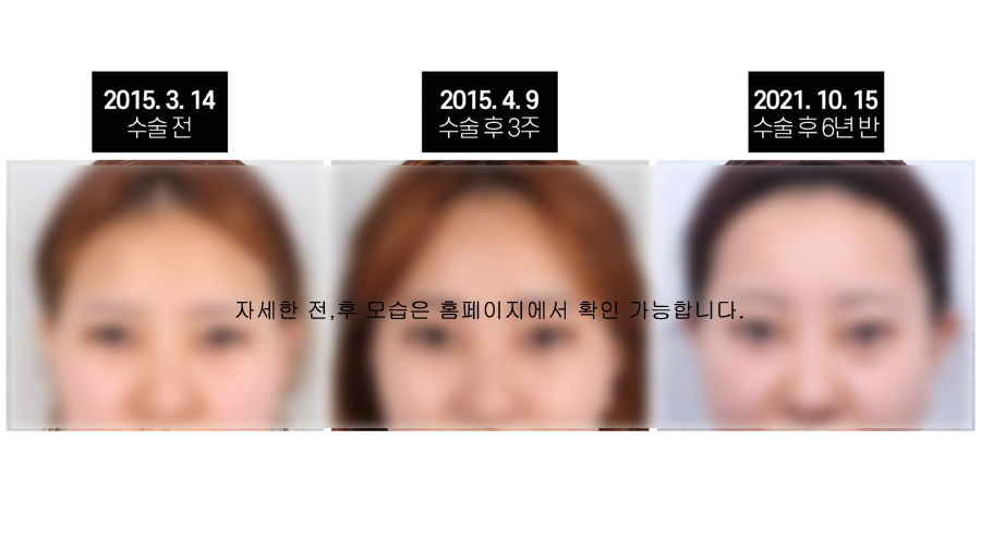 이마거상유지기간 얼마나 가고 또 어떻게 확인할까? 관련 이미지 3