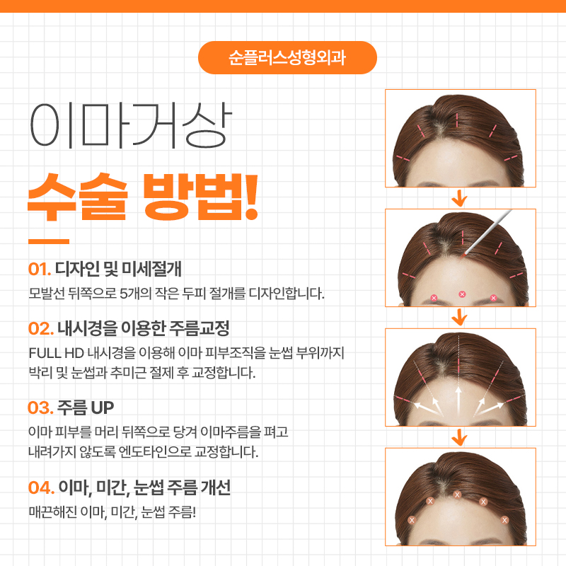 이마거상잘하는곳 어떤 부분을 알아봐야할까요 관련 이미지 4