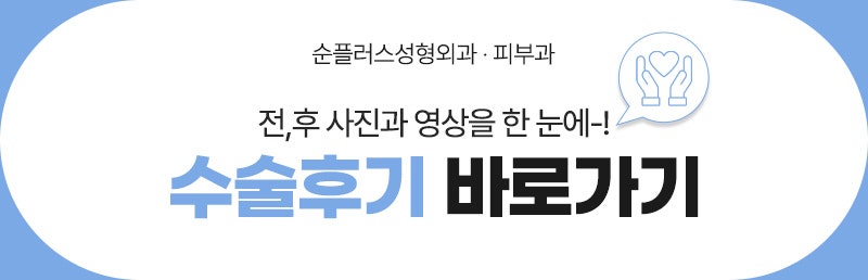 앞트임재수술 복원으로 눈앞머리 자연스럽게 관련 이미지 10