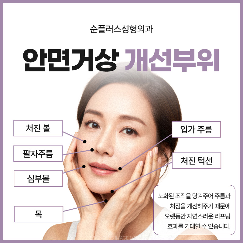 Will the Effects of a Facelift Last a Long Time? image 4