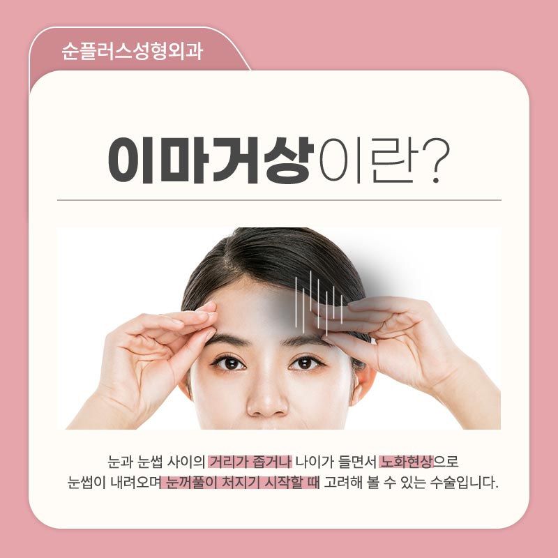 Forehead Wrinkle Removal Surgery, Including Between the Eyebrows and the Bridge of the Nose image 2
