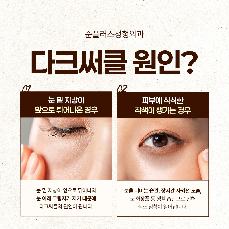 Under-Eye Fat Repositioning: When the Dark Shadow Under the Eyes Is a Concern image 3