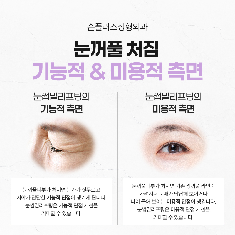 50대 60대 눈썹하거상, 자연스러운 동안 인상의 핵심은 따로 있다. 관련 이미지 4