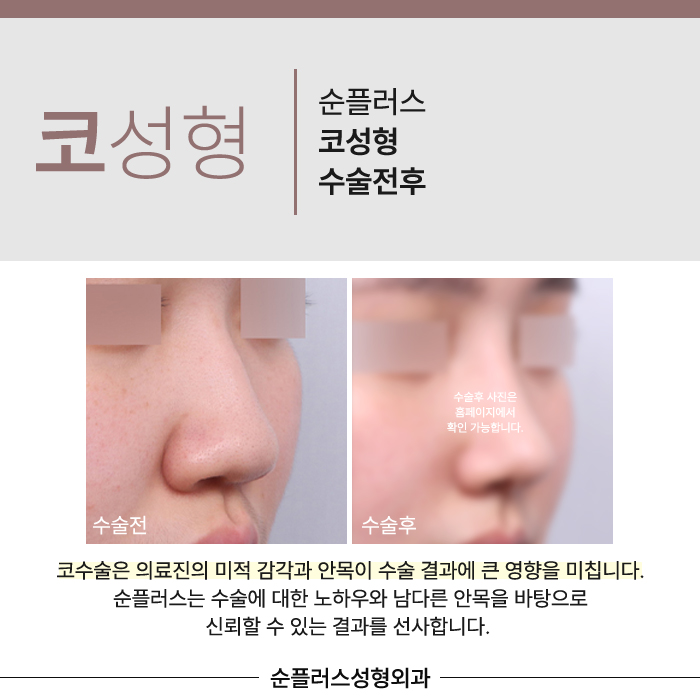 강남코성형외과 비율과 균형을 맞춰야해요 관련 이미지 6
