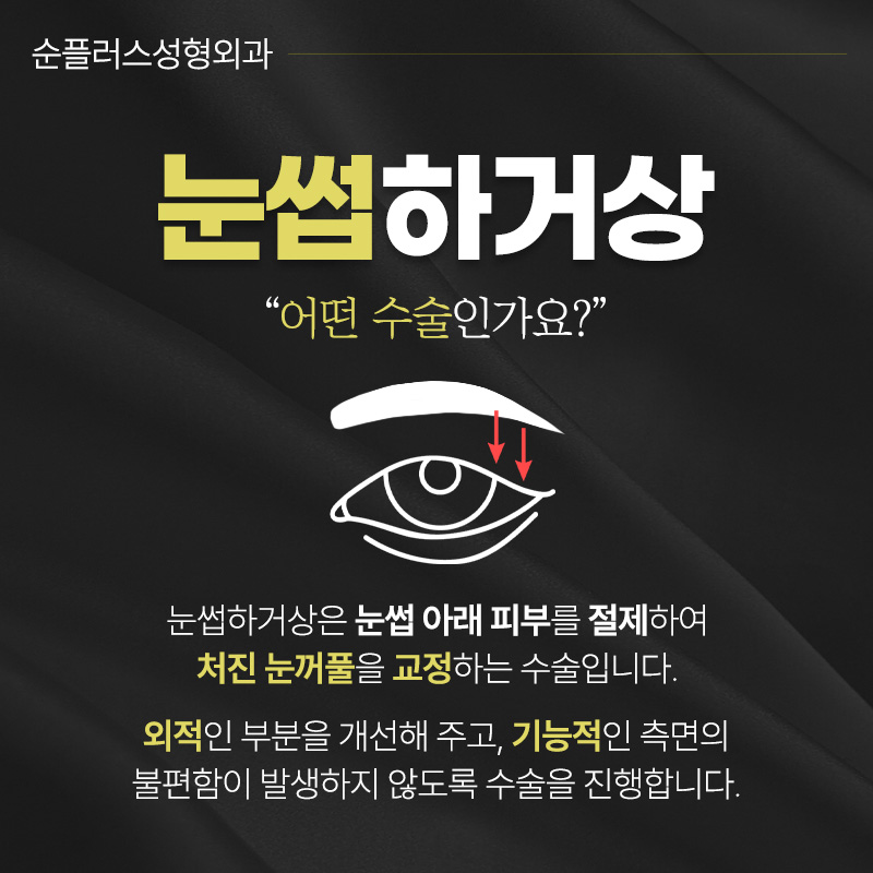 When Aging-Sagging Eyelids Need a Natural Brow Lift [Brow Ptosis Correction] image 2