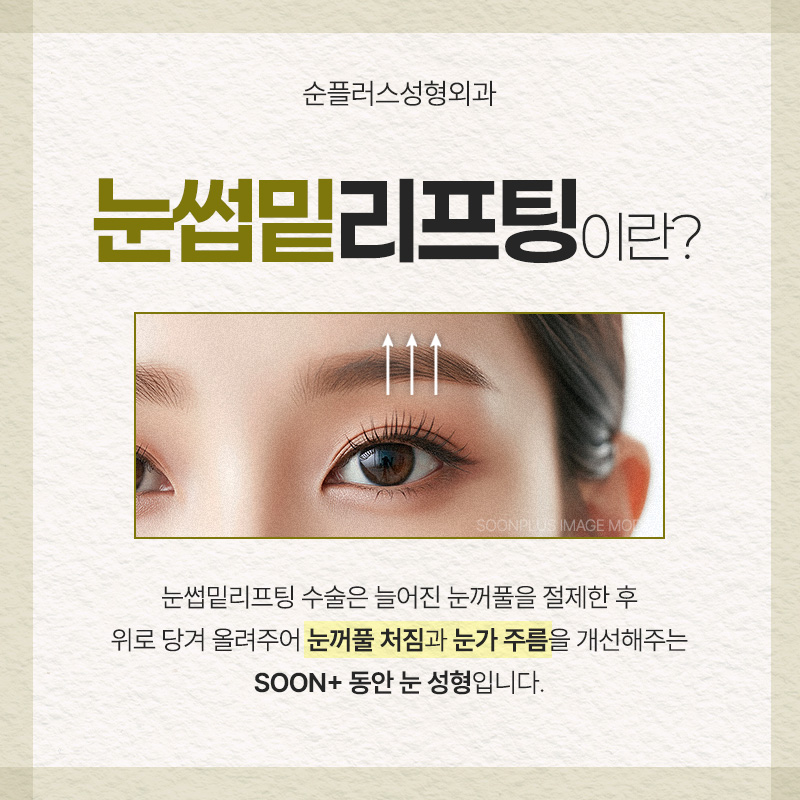 처진 눈꺼풀, 눈썹밑 리프팅 통해 자연스럽게 올려줘 눈매를 또렷하게 관련 이미지 2
