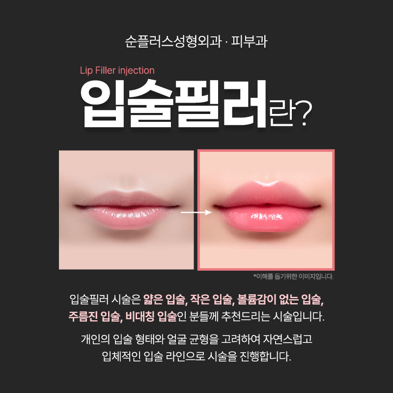 자연스러운 입술필러 유명한곳 선택에 앞서 관련 이미지 2