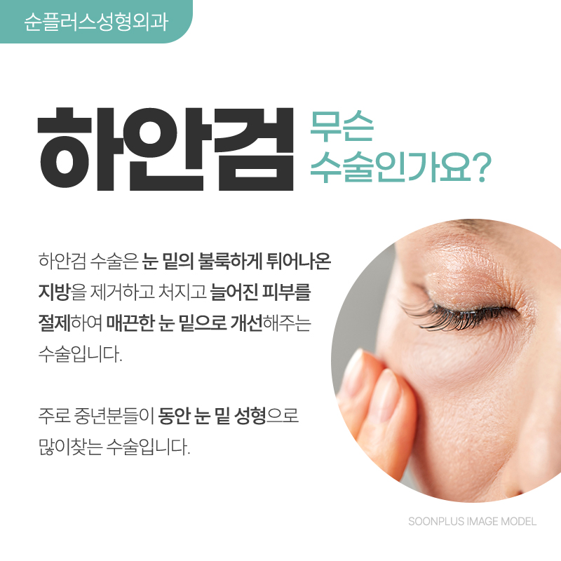 Why Lower Blepharoplasty Is Needed for Middle-Aged Eye Surgery image 2