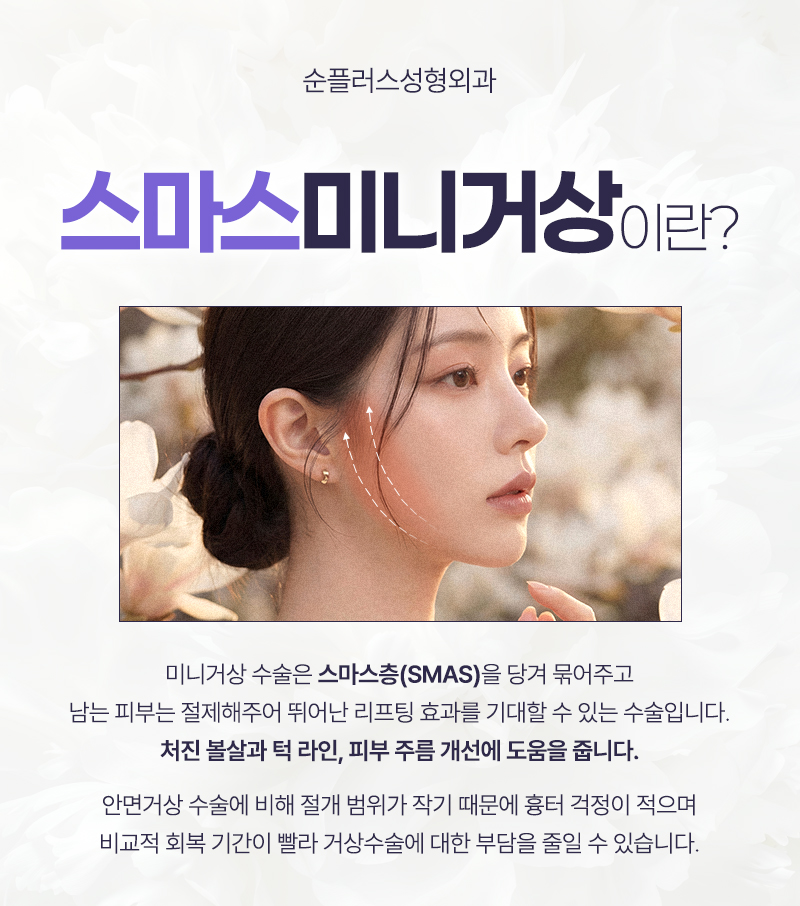 스마스미니거상 처짐의 원인을 찾아 관련 이미지 2