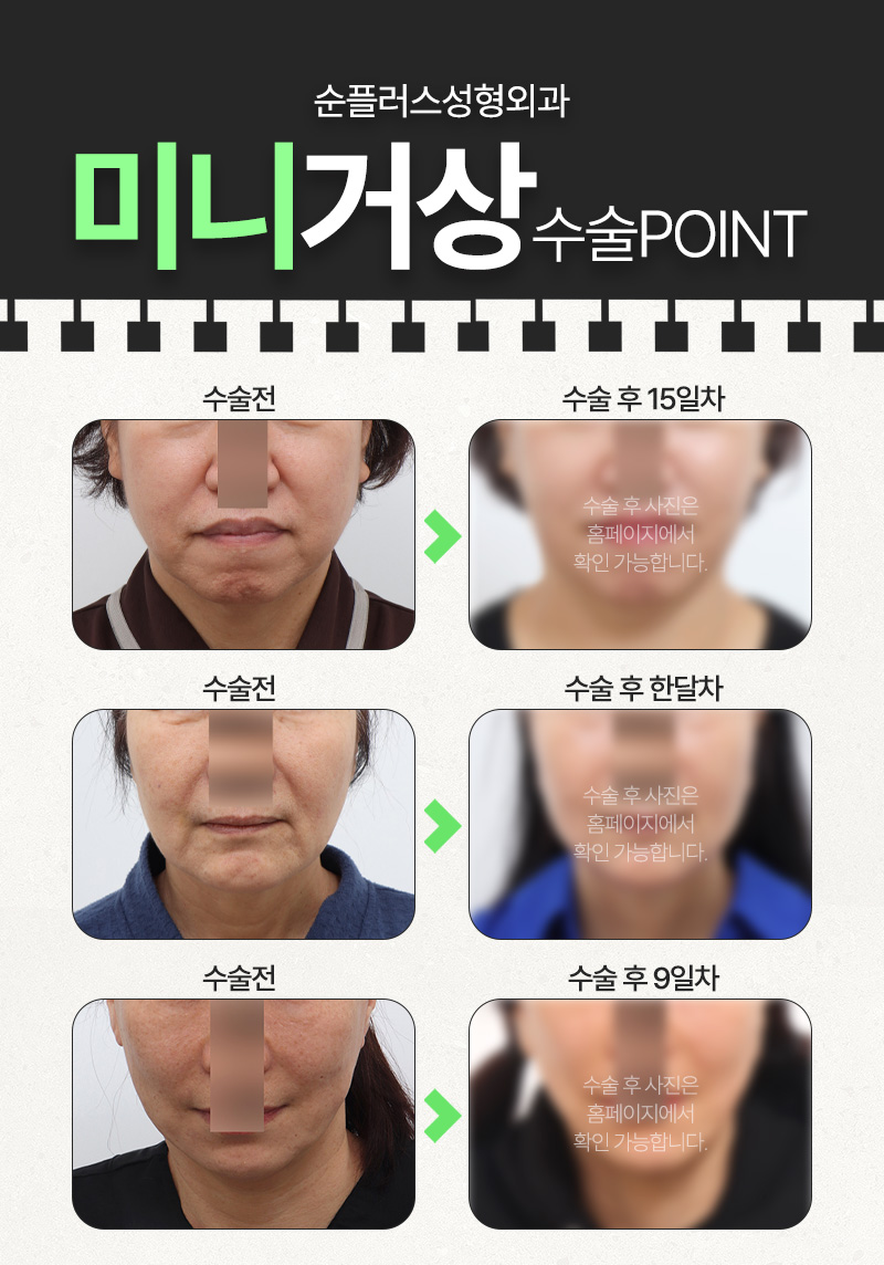 미니거상 추천대상부터 가격 후기 까지 관련 이미지 6