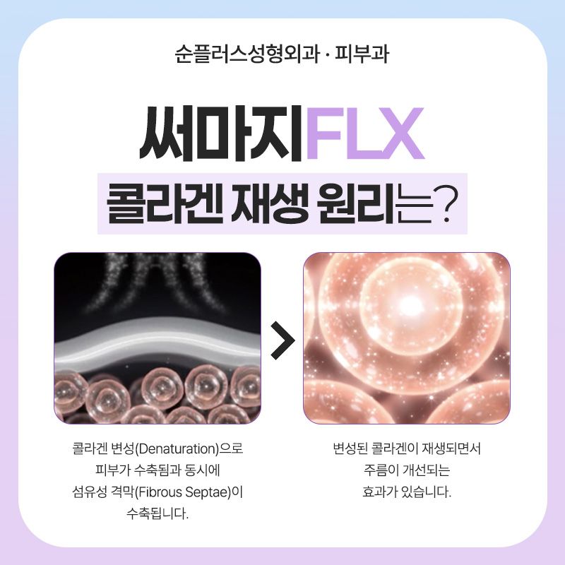 써마지 효과 언제부터 나타날까? 유지기간과 변화 시기 관련 이미지 3