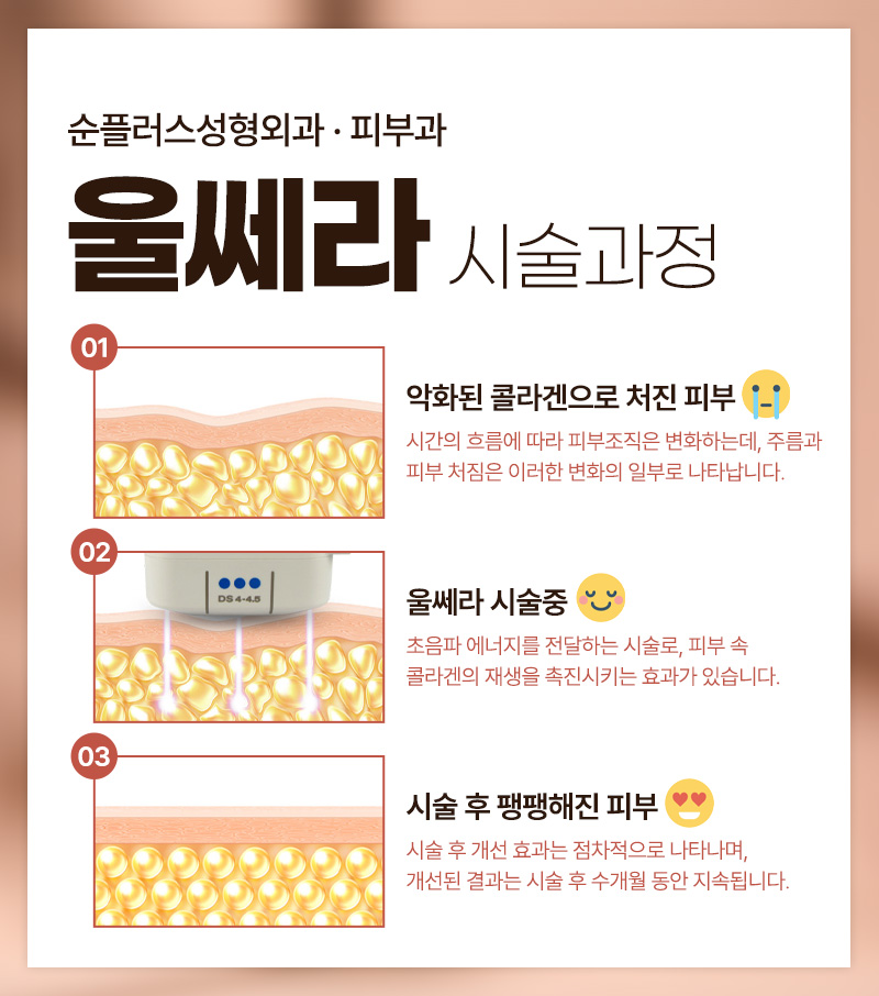 At a place that does Ulthera well: using genuine tips and the recommended shot count according to skin condition, such as 300, 400, and 500 shots image 4