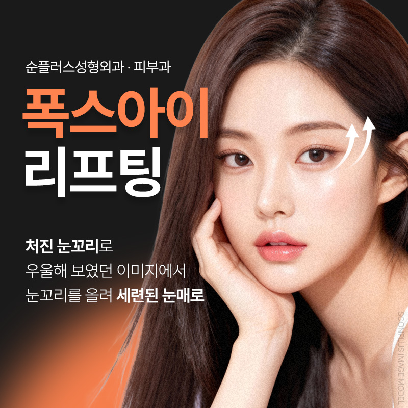Naturally Improving a Drooping Outer Eye Corner: Outer Eye Corner Thread Lifting image 1