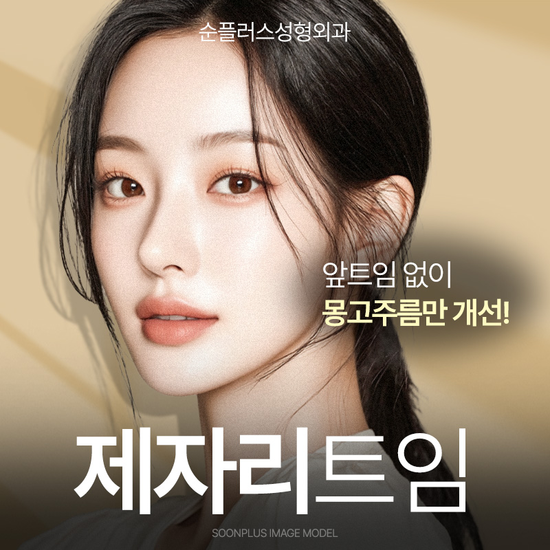 트임 부작용 개선과 몽고주름 제거로 눈매를 부드럽게 [앞트임-제자리트임] 관련 이미지 1