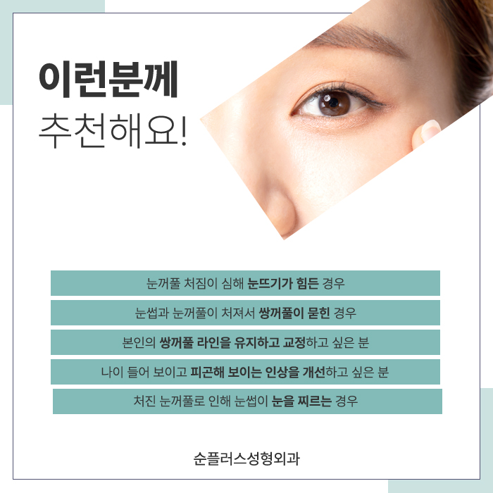 눈썹거상수술 자연스러움을 살리며 관련 이미지 4
