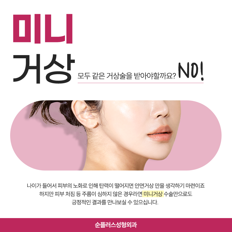 미니안면거상 추천대상과 효과는? 관련 이미지 2