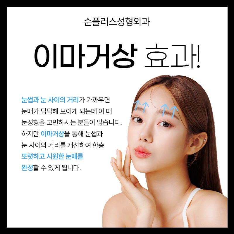 내시경이마거상 어떻게 진행되는지 관련 이미지 3