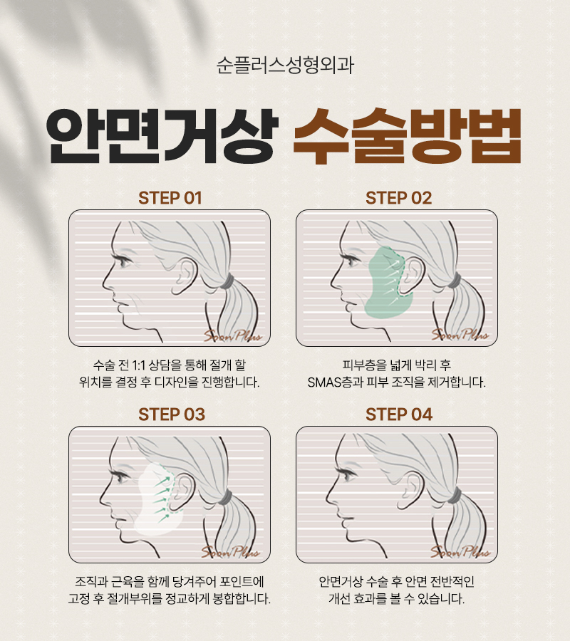 강남 안면거상성형외과 동안으로 가는 길 관련 이미지 4