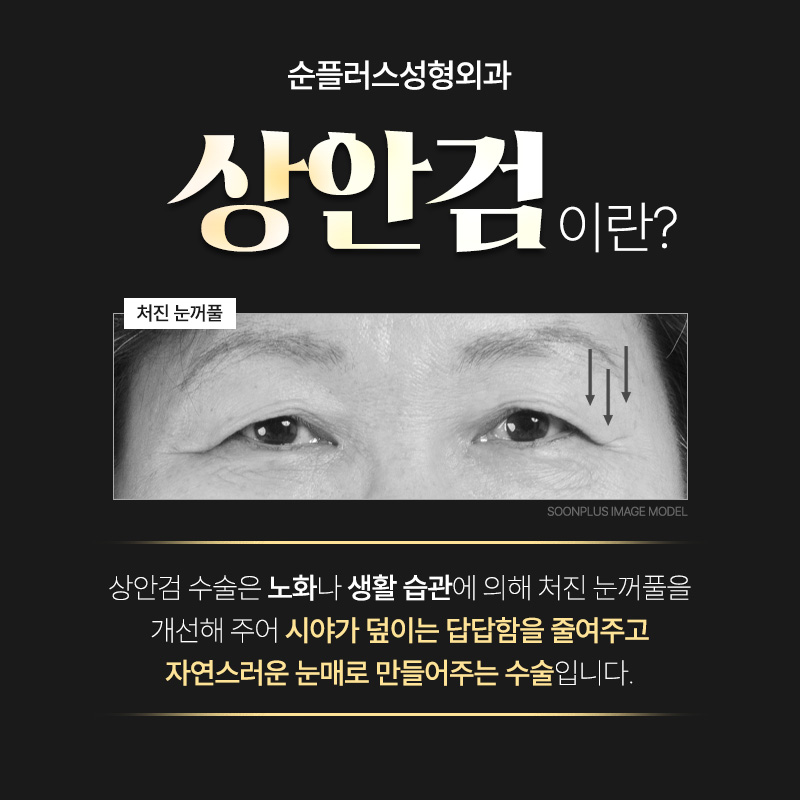 50대 60대쌍꺼풀, 중년눈성형은 처진눈꺼풀도 자연스럽게 개선해야 관련 이미지 2