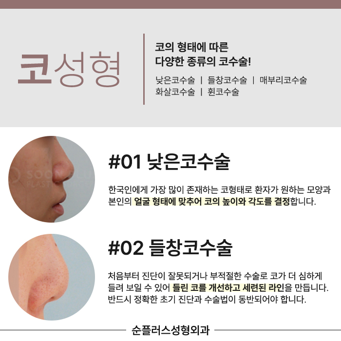 강남코성형외과 비율과 균형을 맞춰야해요 관련 이미지 4