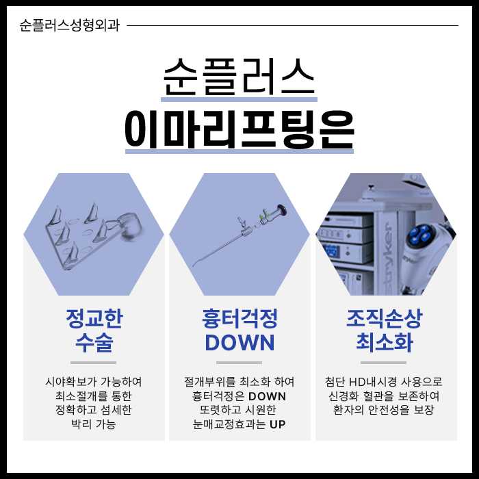 이마리프팅 정교함의 차이로 관련 이미지 5