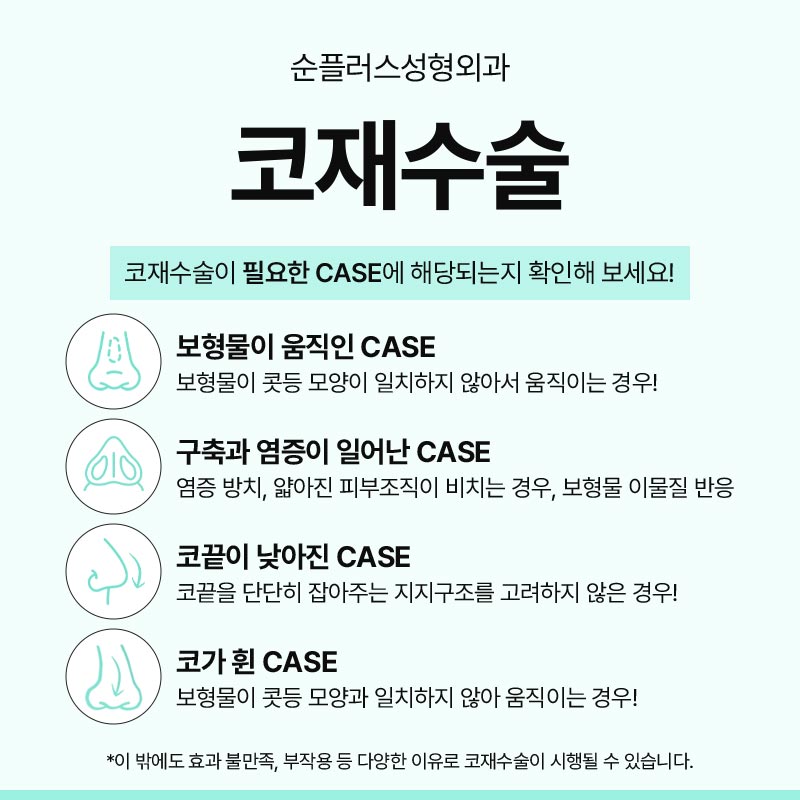 코재수술성형외과 이전에 문제점이 무엇인지 관련 이미지 3