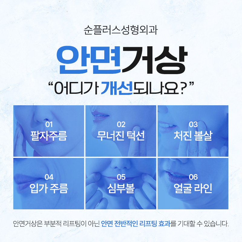안면거상술 왜 필요한가? 효과, 수술방법, 주의사항까지 관련 이미지 3