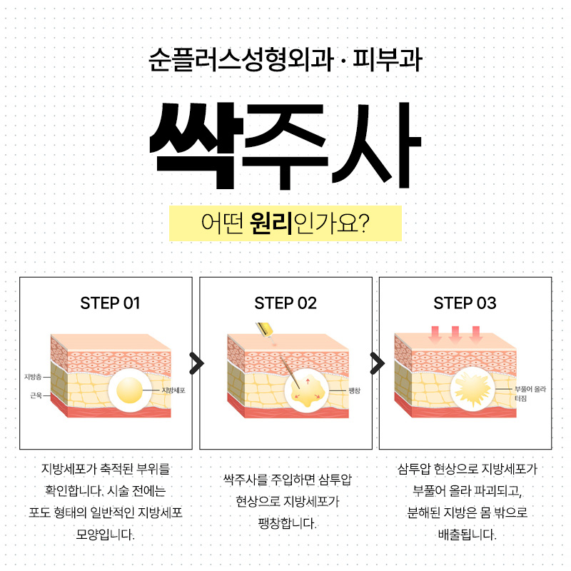 순플러스성형외과 &middot; 피부과  몸속 지방과 군살을 싹-! 싹주사 관련 이미지 4