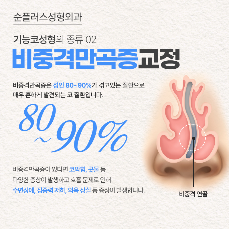 기능코수술 미용적 개선과 비염 비중격만곡증 개선으로 편안한 숨길 관련 이미지 4