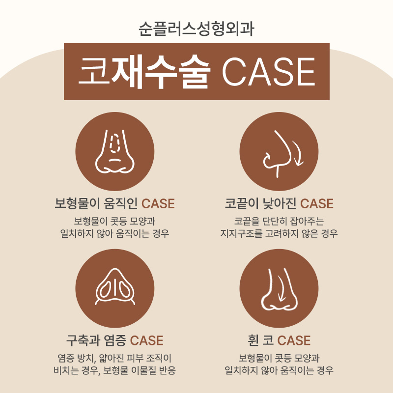 코재수술성형외과 비율과 균형을 고려해 관련 이미지 4