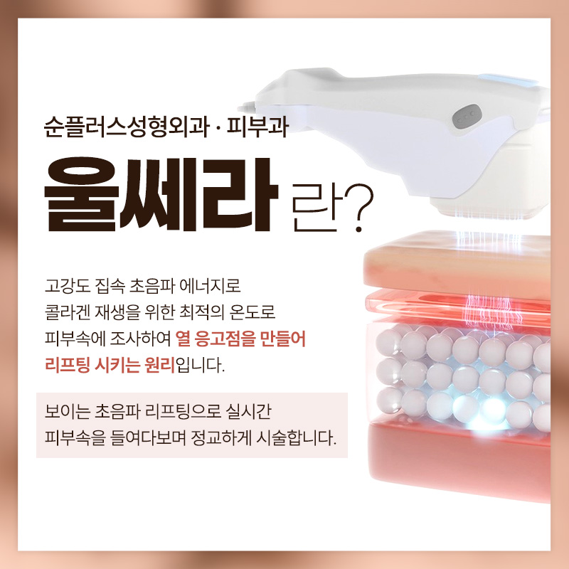 At a place that does Ulthera well: using genuine tips and the recommended shot count according to skin condition, such as 300, 400, and 500 shots image 2