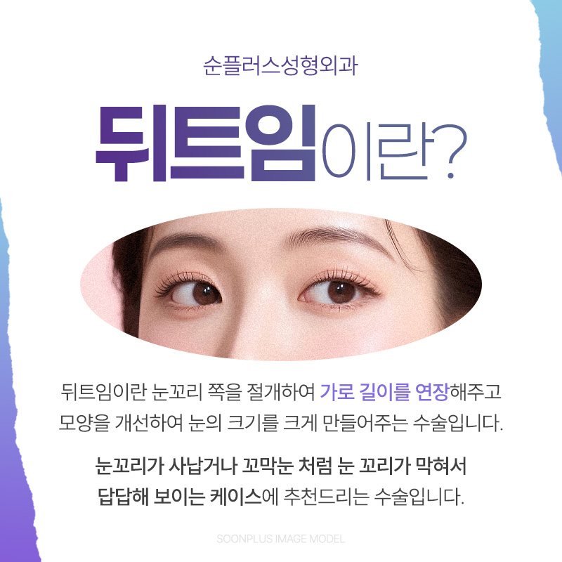 Lateral Canthoplasty (Outer Corner Surgery): Expanding the Horizontal Length While Lowering the Outer Eye Corner for a More Open Look image 2