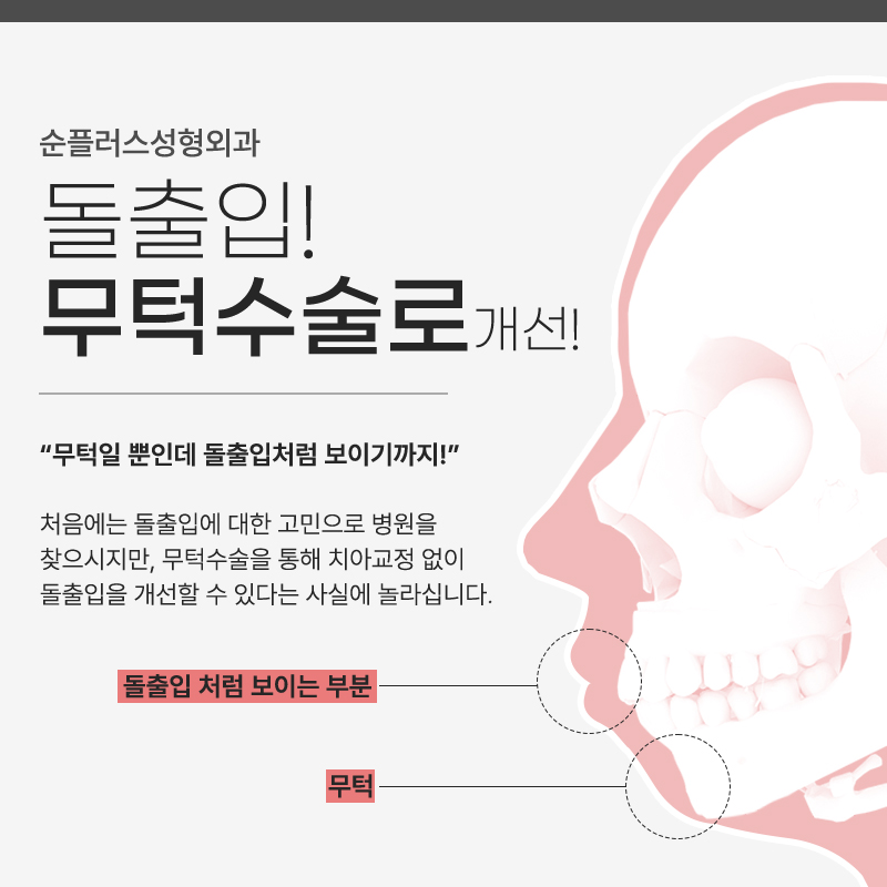 짧은턱 무턱 수술 빠른 회복, 개선 원할때 관련 이미지 5