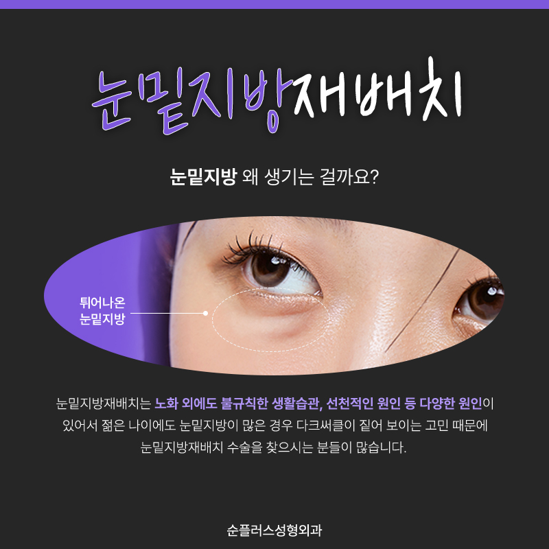 Lower Eyelid Fat Surgery Cost: If Bumpy Under-Eyes Are a Concern image 2