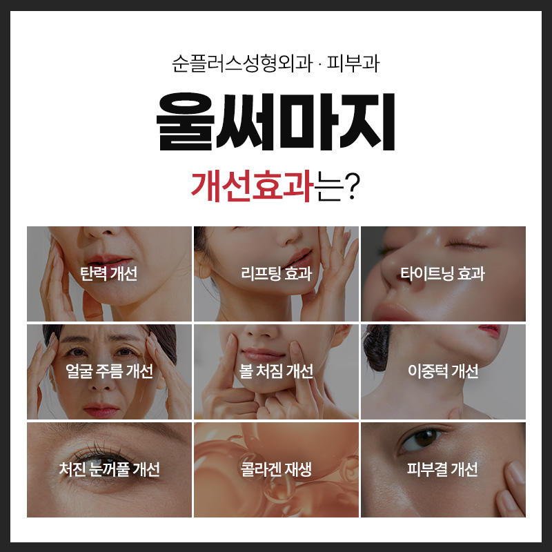 처진 피부에 리프팅 효과와 콜라겐 재생으로 타이트닝 효과를 동시에 울써마지 (울쎄라+써마지) 관련 이미지 4