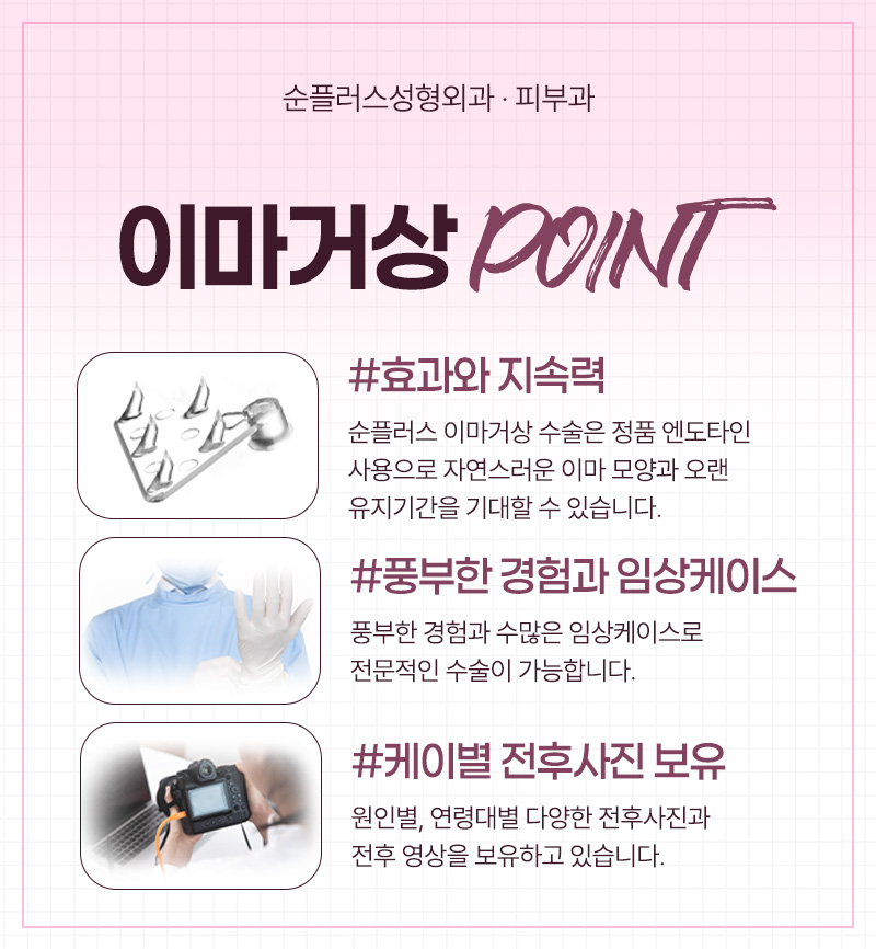처진 눈매, 자연스럽게 시원해지는 방법 - 이마거상술 관련 이미지 6
