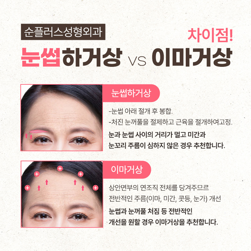 처지는 눈꺼풀 중년눈수술 눈썹하거상 관련 이미지 3
