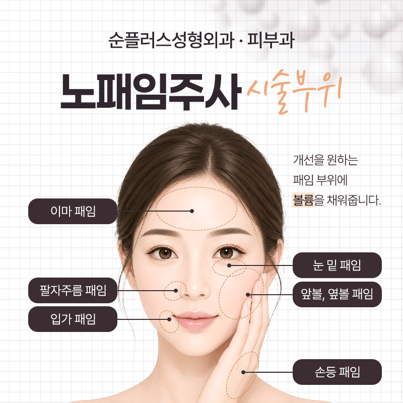 노패임주사, 꺼진 옆볼 앞볼에 자연스러운 볼륨을 더하다. 관련 이미지 4