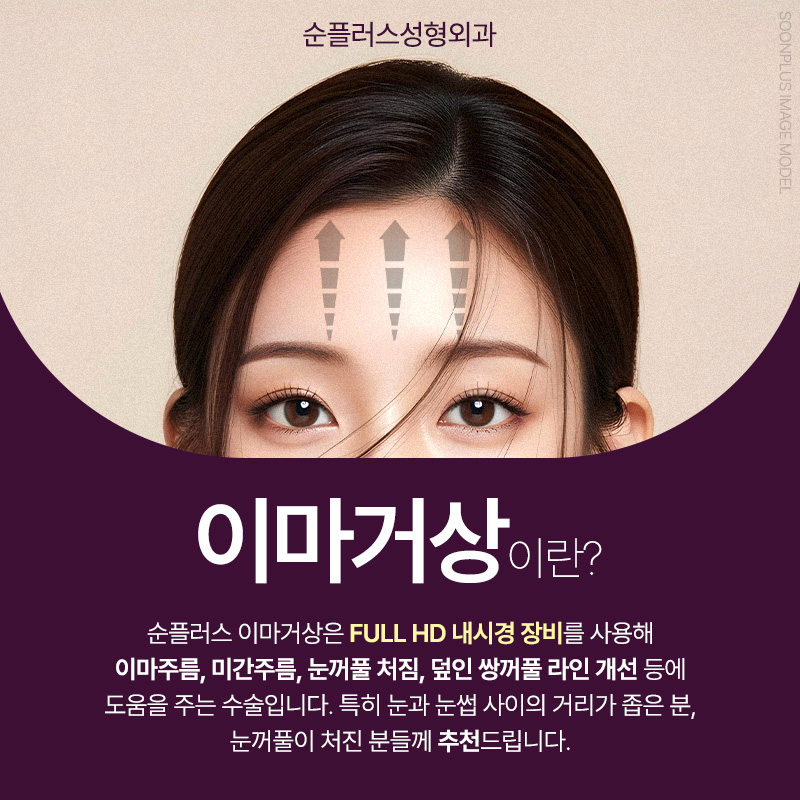 Before and after a forehead lift: what differences in effect might there be? image 2