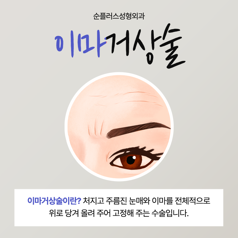 이마거상술잘하는곳 눈의 변화에도 관련 이미지 2