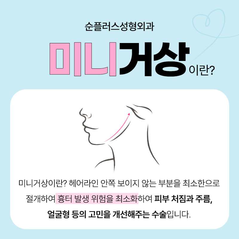 Mini Facelift to Improve Loose Skin Elasticity image 2
