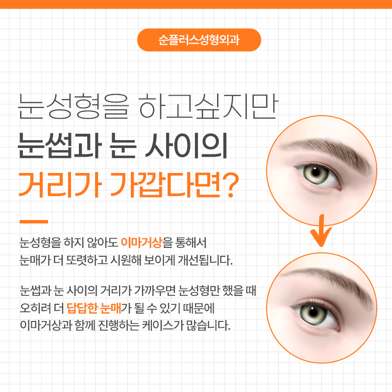 이마거상잘하는곳 어떤 부분을 알아봐야할까요 관련 이미지 3