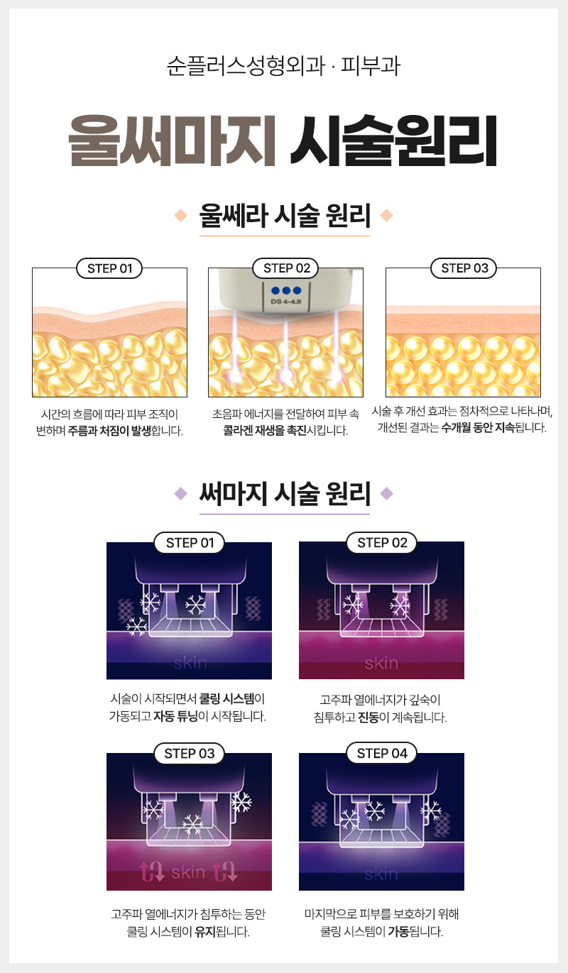 신사 울써마지 통증과 효과는 어떤지 관련 이미지 3