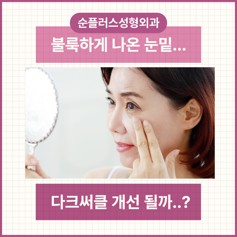 눈밑지방수술 꺼짐과 돌출이 동반되었을때 관련 이미지 2
