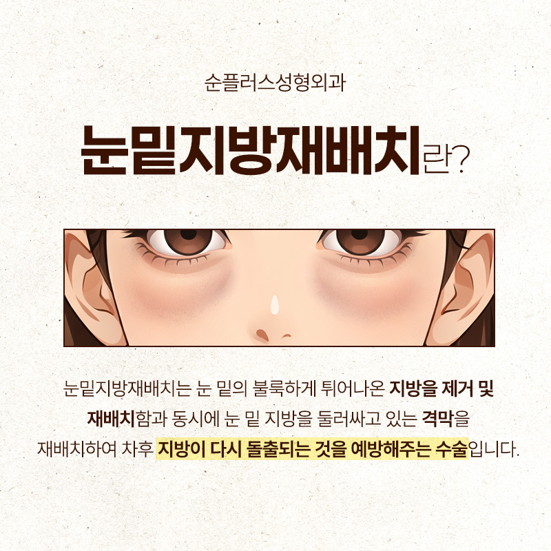 Under-Eye Fat Repositioning: When the Dark Shadow Under the Eyes Is a Concern image 2
