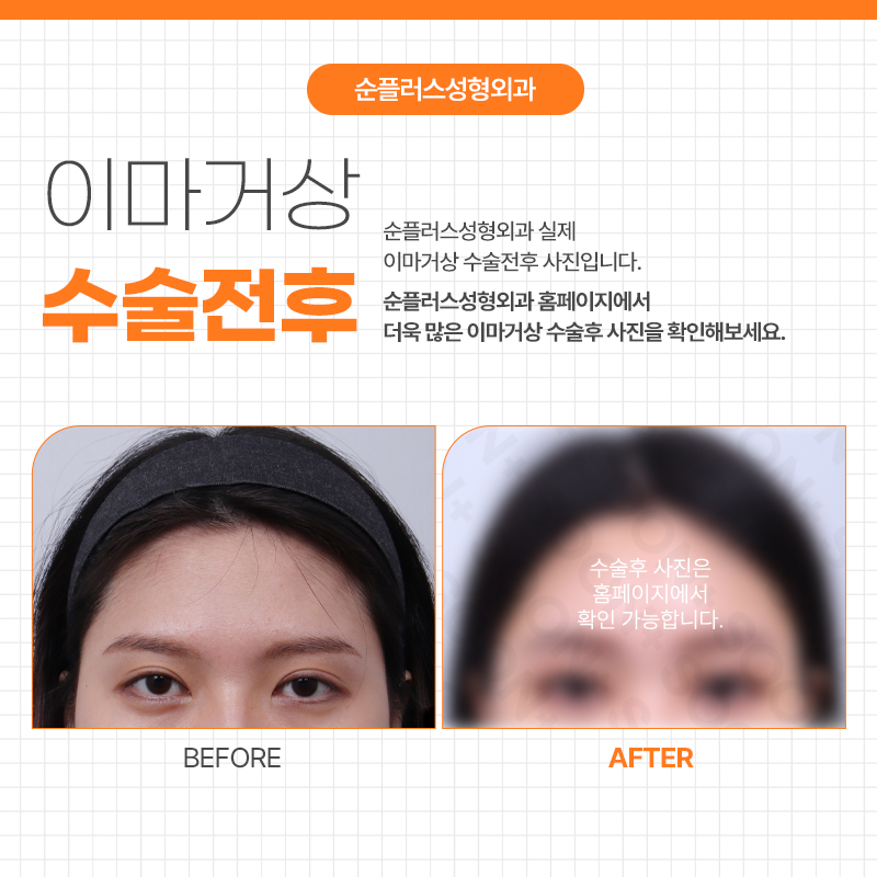 이마거상잘하는곳 어떤 부분을 알아봐야할까요 관련 이미지 5