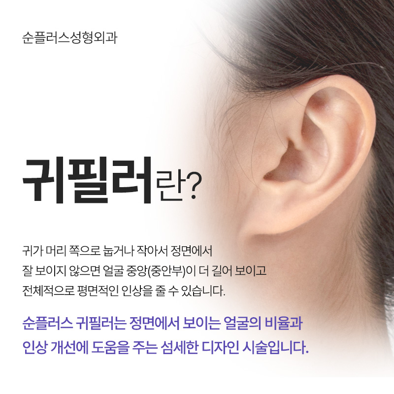 Ear filler effects that enhance the three-dimensional look of the face, management, duration, and precautions image 2