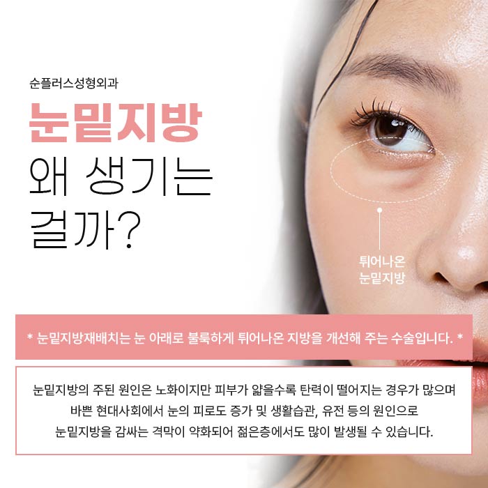 눈밑지방재배치수술 비용과 과정도 꼼꼼하게 관련 이미지 2
