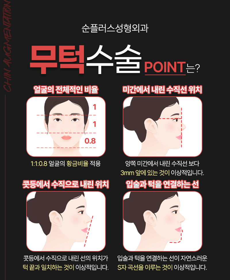 짧은턱 작은턱 일명 무턱콤플렉스 개선위해 관련 이미지 6
